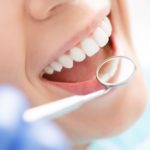 Perte de dents : quels rapports avec les troubles cognitifs ?