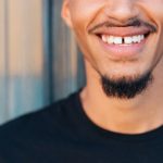 Pourquoi dit-on qu’avoir les dents écartées porte bonheur ?